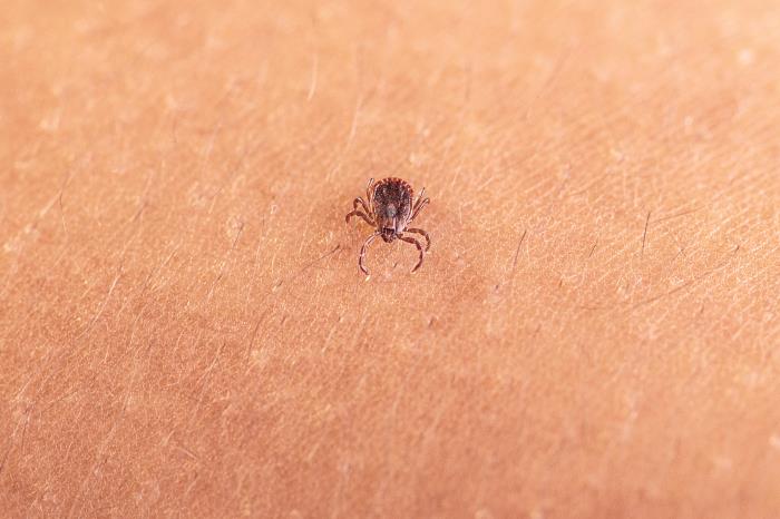 New Tick Alert To Watch Out For In New Jersey
